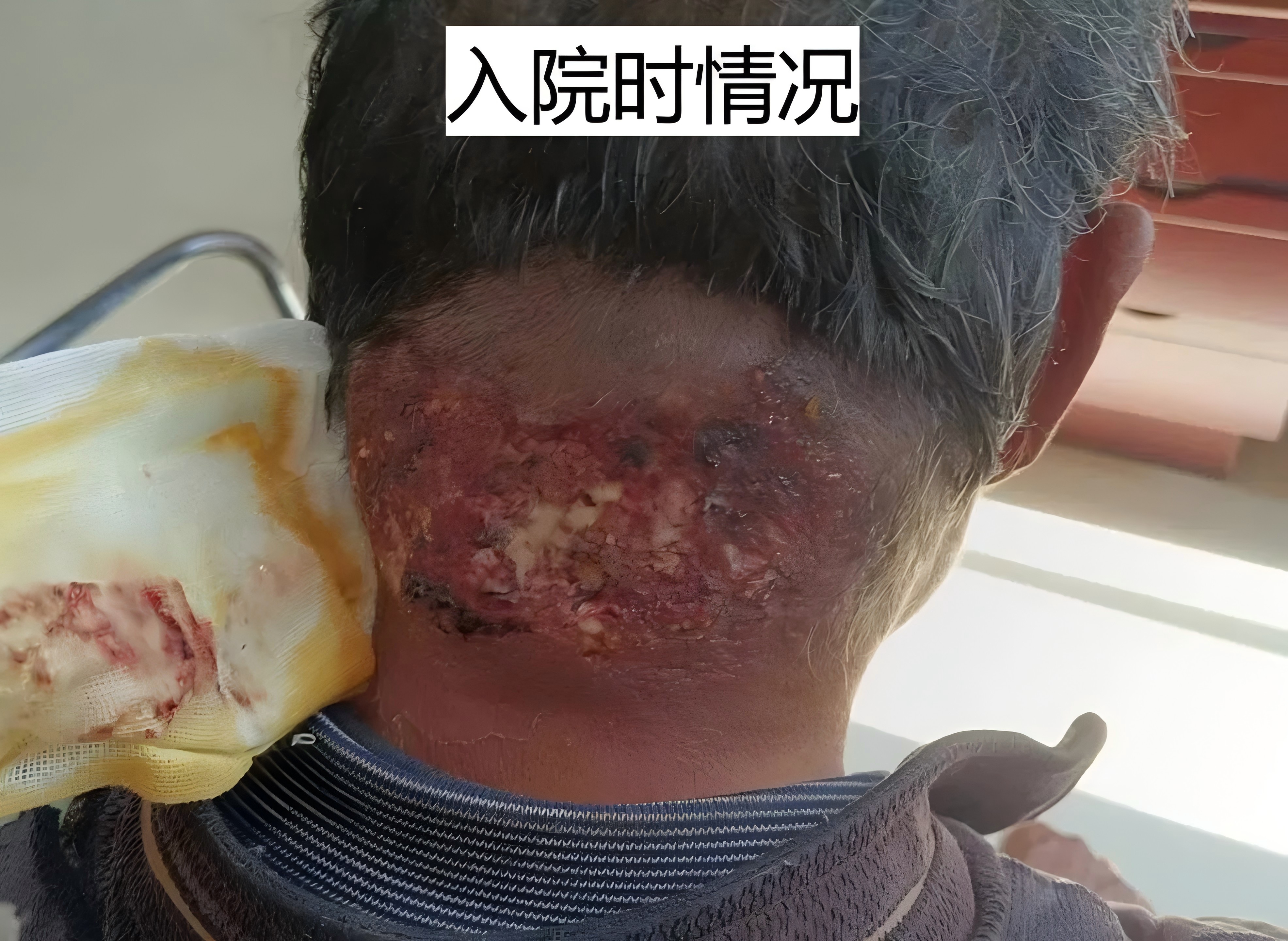 vsd入院时情况.jpg